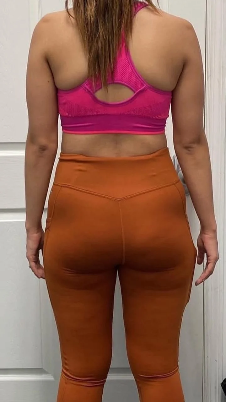 Antes do programa Pilates em Casa — aluna 4