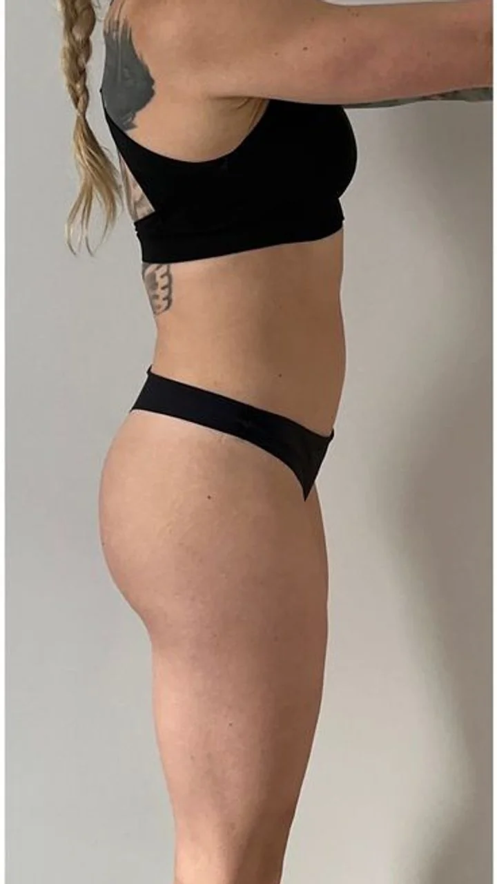 Antes do programa Pilates em Casa — aluna 5