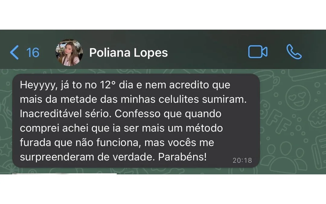 Depoimento de Poliana Lopes: no 12º dia mais da metade das celulites sumiram; achou que seria mais um método que não funciona e se surpreendeu